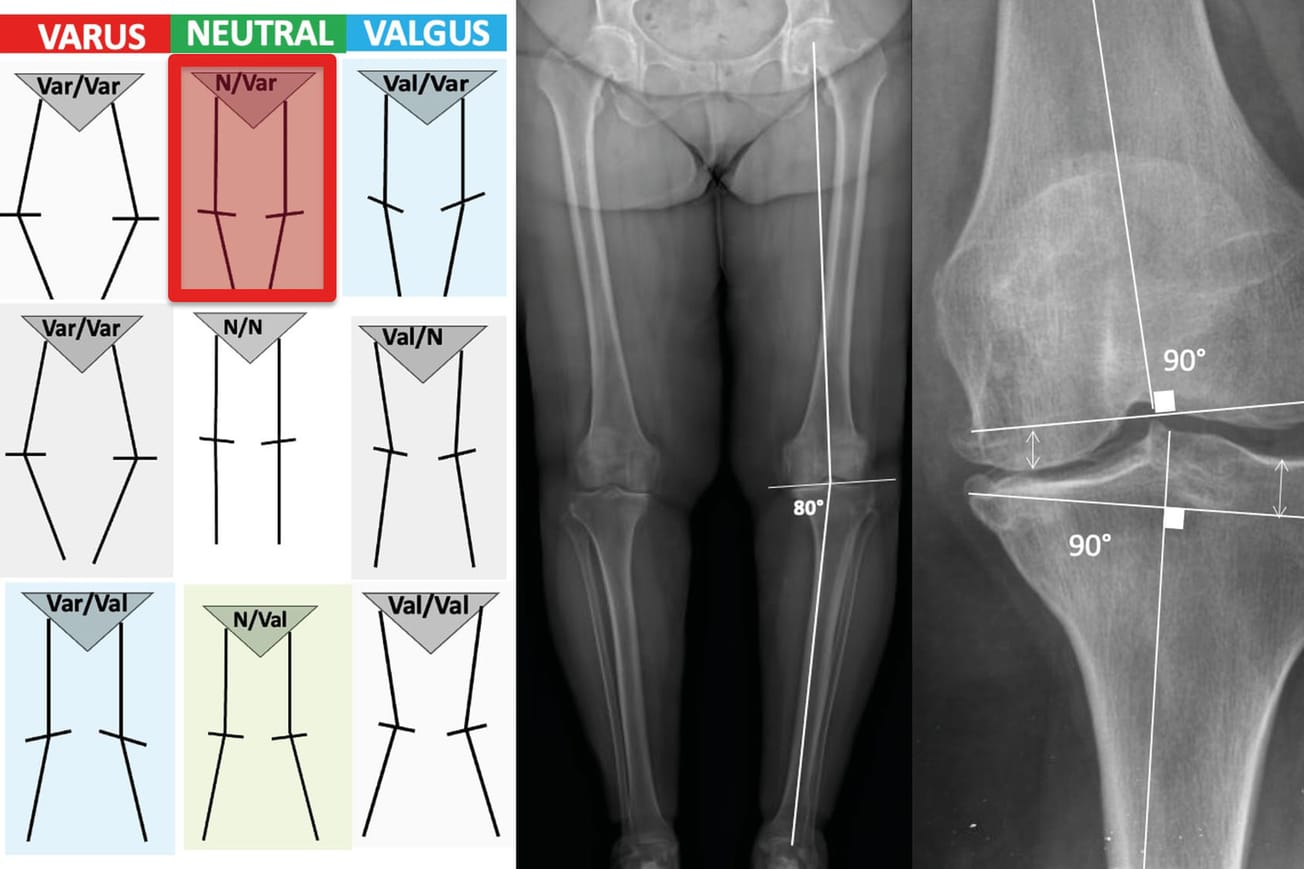 L chographie pour le chirurgien orthop diste